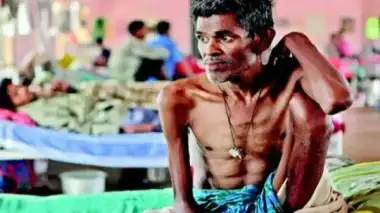Nutritional Support for 60 TB Patients Under the Ni-kshay Mitra Initiative