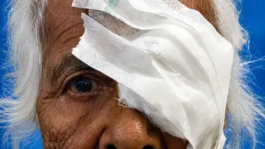 Nai Kiran Bringing Light Through Cataract Surgeries